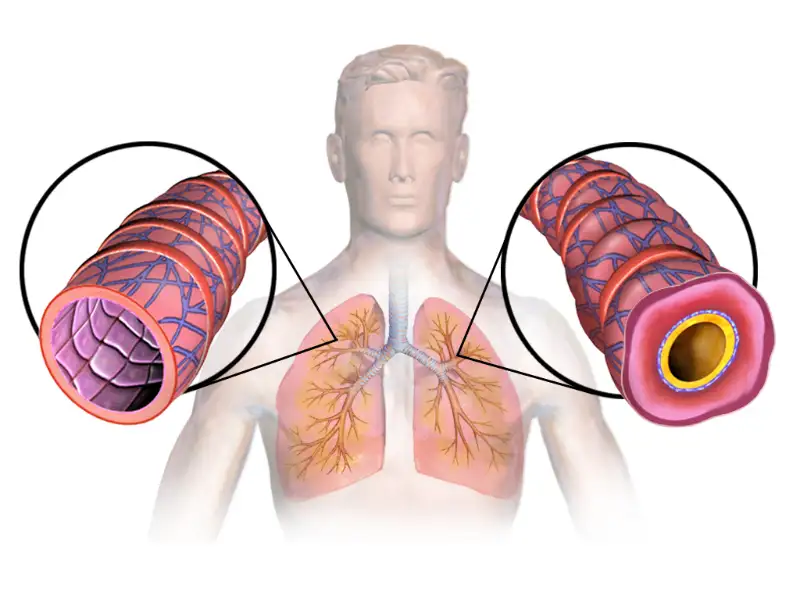 Best Doctors For Asthma Treatment In Sushruta Ayurveda Bliss Hospital,
